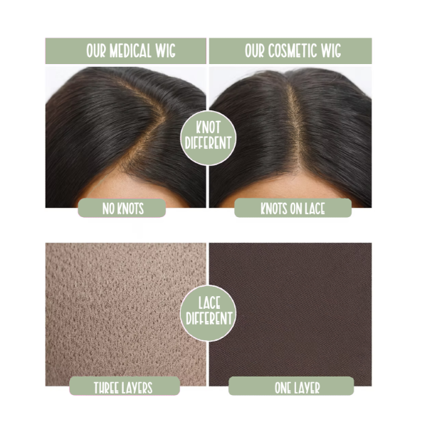 Revivify Cranial Prosthsis
